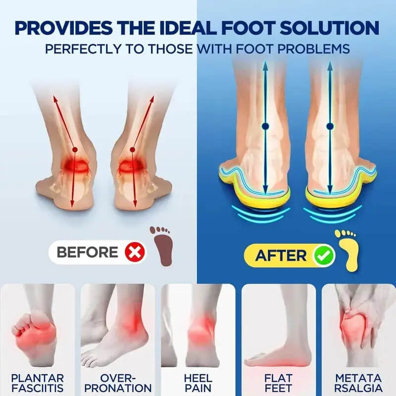 Magnetic Massage Insoles – Breathable & Comfortable All-Day Wear
