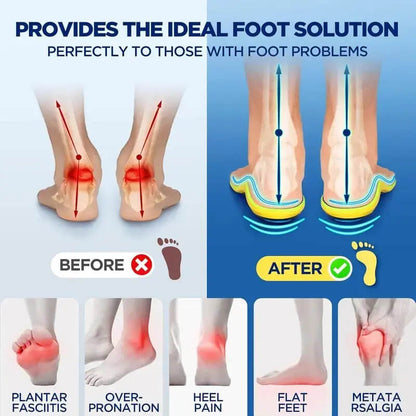 Magnetic Massage Insoles – Breathable & Comfortable All-Day Wear