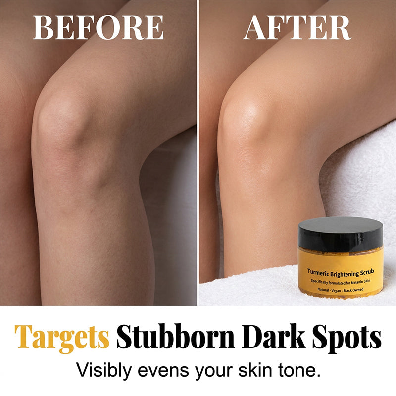 ✨Last Day Buy 3 get 1 free💗Turmeric Exfoliating Body Scrub